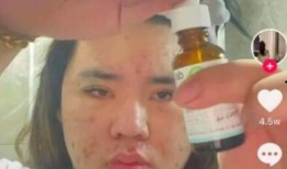 看朋友吃瓜视频,一场看瓜视频引发的狂欢