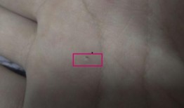 给吃瓜的男孩点痣好吗视频,见证颜值逆袭之旅