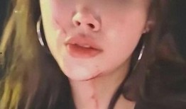 益阳吃瓜最新事件视频,揭秘网络热议背后的真相